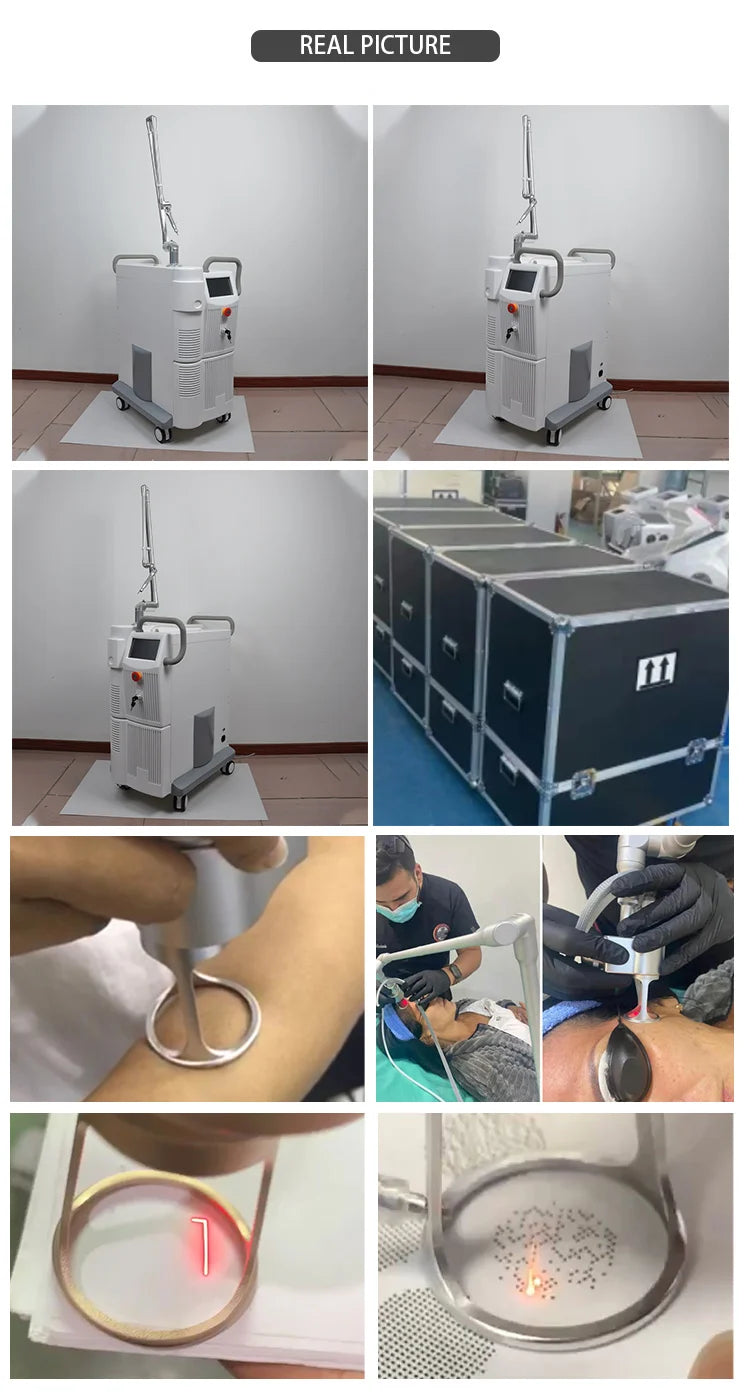 Machine de traitement laser fractionné 4D Fotona Co2, 10600nm, pour la resuction des cicatrices d'acné, nouveau design