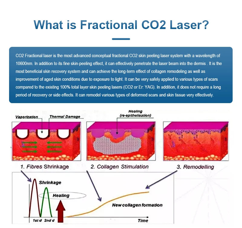 Machine de traitement laser fractionné 4D Fotona Co2, 10600nm, pour la resuction des cicatrices d'acné, nouveau design