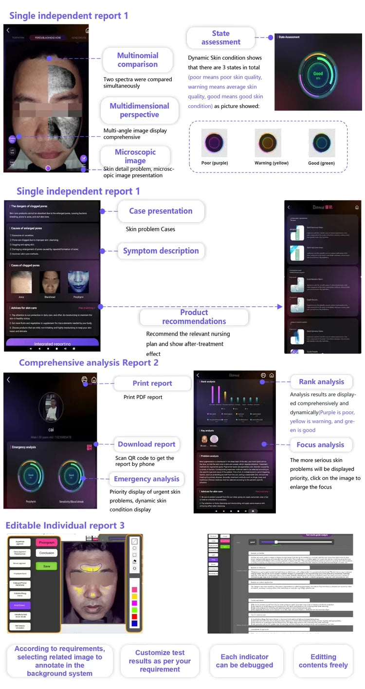 Analyseur de peau visuel facial intelligent 3D numérique AI, haute Configuration 36 millions A6, avec détecteur microscopique portatif, 2026