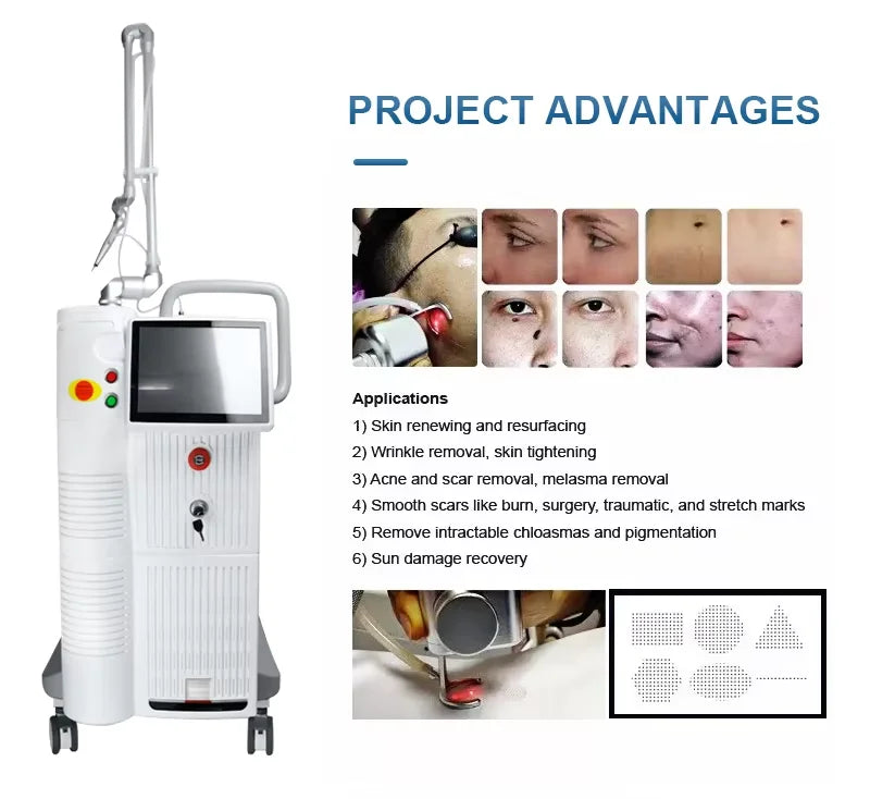 Machine de traitement laser fractionné 4D Fotona Co2, 10600nm, pour la resuction des cicatrices d'acné, nouveau design