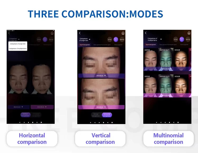 Analyseur de peau visuel facial intelligent 3D numérique AI, haute Configuration 36 millions A6, avec détecteur microscopique portatif, 2026