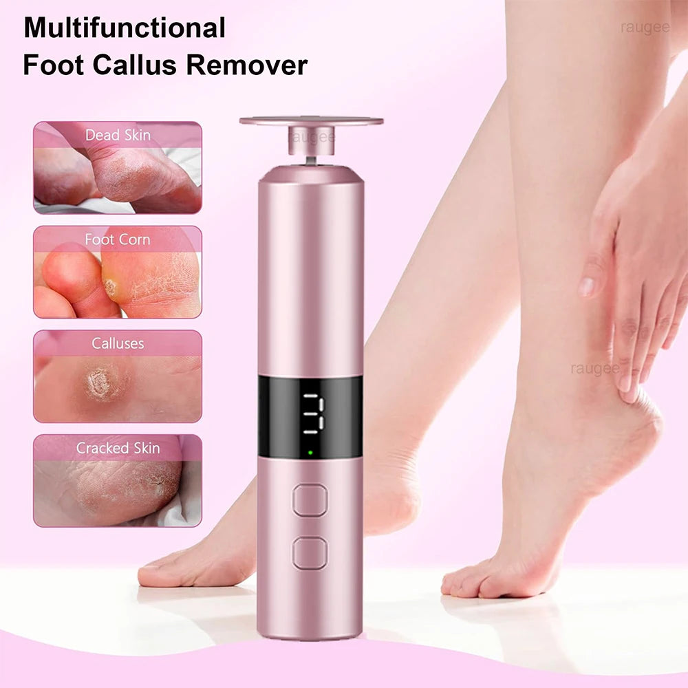 Appareil électrique multifonction pour pieds, élimine les durillons, peau morte et callosités, design rose doré